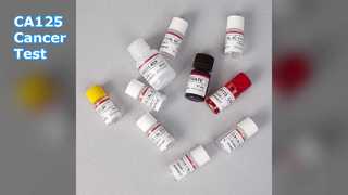 Test ELISA CA125 per il monitoraggio del cancro