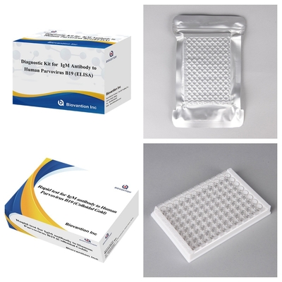 Kit di test ELISA avanzato per parvovirus umano B19 IgM per il rilevamento e lo screening della gravidanza