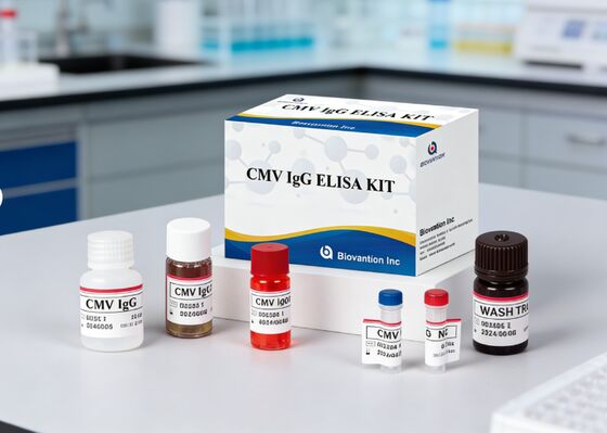 Laboratorio o ospedale Kit di prova CMV IgG Elisa ad alta precisione