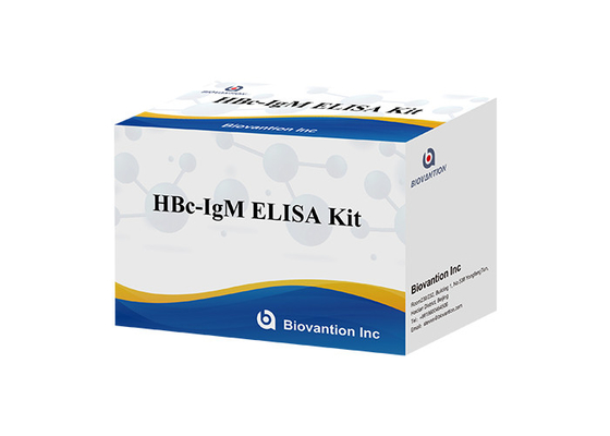 Prova di Igm dell'anticorpo del centro di Kit Hepatitis B della prova di ISO13485 HBc IgM