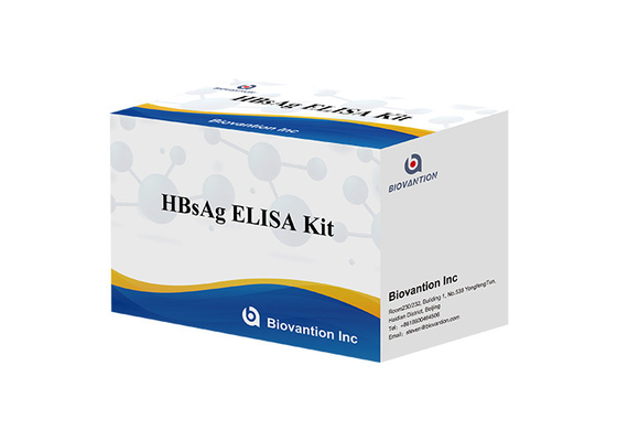 Antigene di superficie Elisa Test di HBsAg Elisa Kit Hepatitis B della malattia infettiva