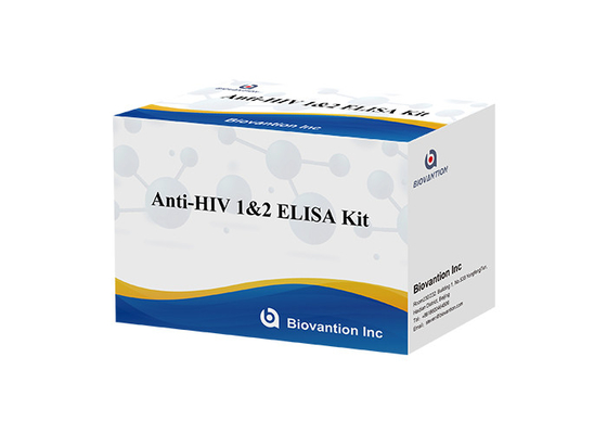 Anti virus umano di immunodeficienza di HIV 1&amp;2 Elisa Test Kit For Human