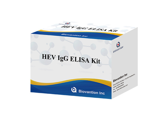 Anticorpo umano di HEV Igg Elisa Kit Diagnostic For IgG al virus di epatite E