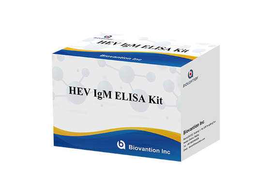 Plasma di HEV IgM Elisa Test Kit Serum Vs per rilevazione dell'anticorpo