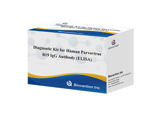 Kit diagnostico per il parvovirus B19 IgG test kit elisa Anticorpo per campioni di siero