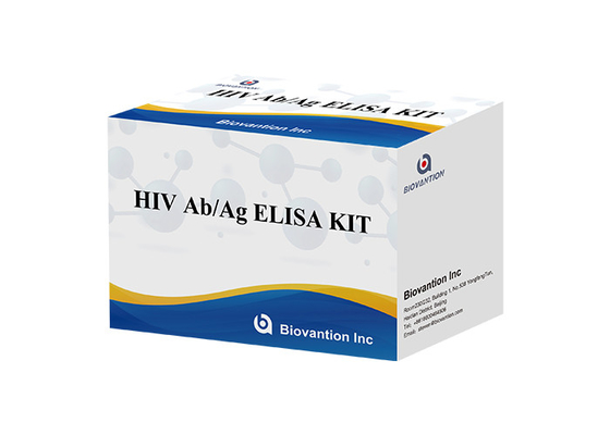 Analisi ELISA Kit della generazione del Hiv quarto della prova ab AG di HIV ISO13485 60 minuti