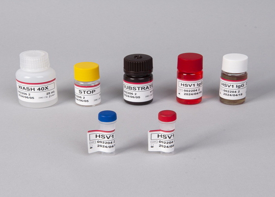 Anticorpi contro il virus dell'immunodeficienza umana (HIV) /kit di prova ELISA per gli antigeni