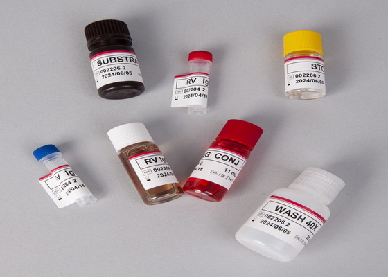 Alpha Fetoprotein AFP Elisa Test Kit per laboratorio o ospedale