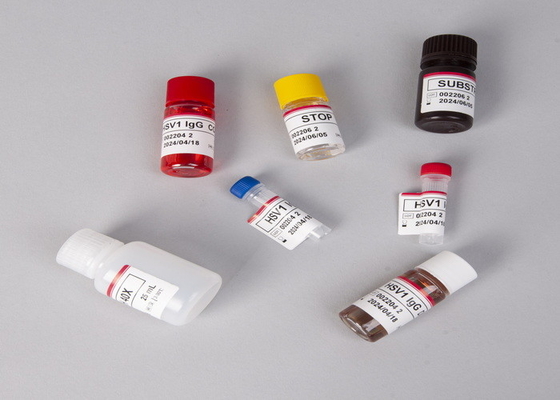 Per laboratorio o ospedali Kit di prova Elisa di gonadotropina corionica beta-umana ad alta precisione