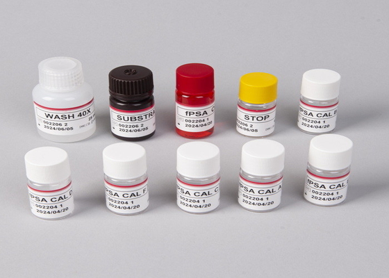 Prevenire in anticipo l'infezione da HIV con test di Elisa