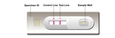 Autotest in laboratorio o in ospedale, test rapido di alta precisione di Leishmania Ab