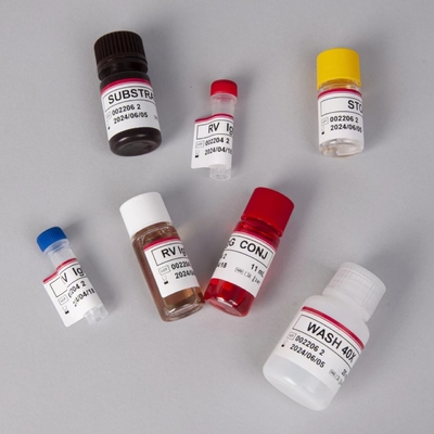 Kit di prova RV-G Elisa per la diagnosi del tipo di campione di plasma