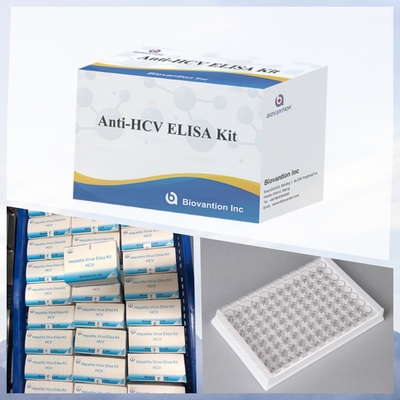 Reagenti per l' immunoassaggio enzimatico Kit di prova Elisa per il rilevamento degli anticorpi del virus dell' epatite C (VHC)