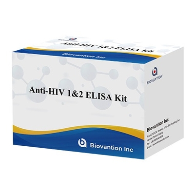 Kit di prova HIV Elisa Durata di conservazione 18 mesi Test Elisa ad alta sensibilità e specificità