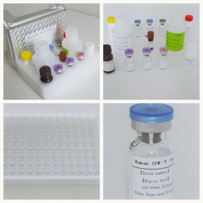 Siero Plasma TB-IGRA