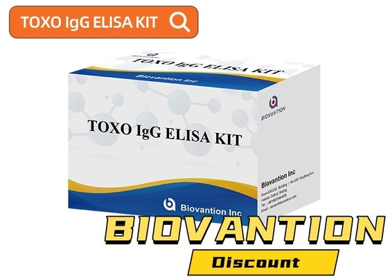 TOXO Ig G Sensitive and Specific Elisa Test Kit per il monitoraggio delle malattie