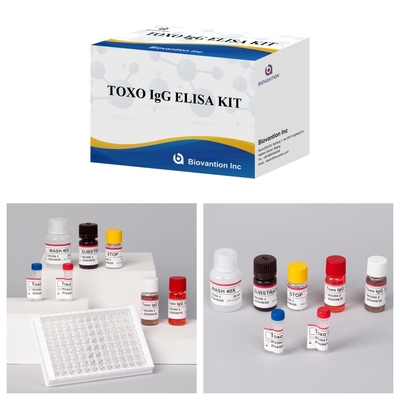 TOXO Ig G Sensitive and Specific Elisa Test Kit per il monitoraggio delle malattie