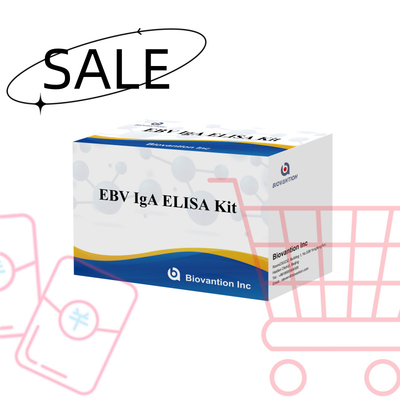 Kit di prova Elisa professionale per il kit diagnostico per gli anticorpi IgA contro EBV-Zta