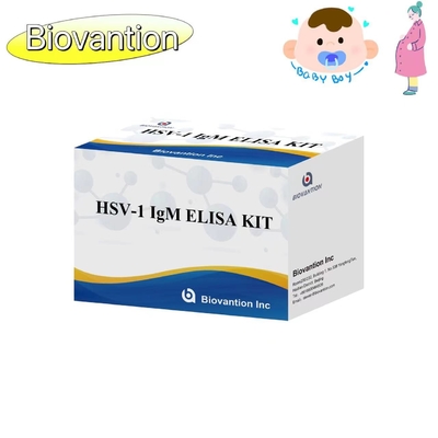 Kit di test ELISA con torcia HSV 1 IgM Reagente diagnostico IVD ad alta velocità di vendita