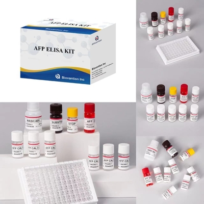 AFP Alpha Fetoprotein Elisa Test Kit Prodotti legati agli enzimi Tempo di trasporto breve