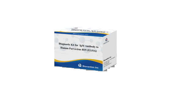 Kit diagnostico per il parvovirus B19 IgG test kit elisa Anticorpo per campioni di siero