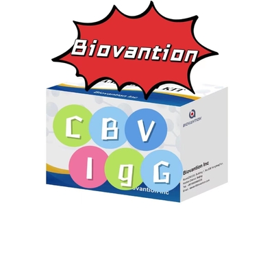 Kit diagnostico per anticorpi anti-CBV-IgG kit di prova ELISA kit di prova del siero
