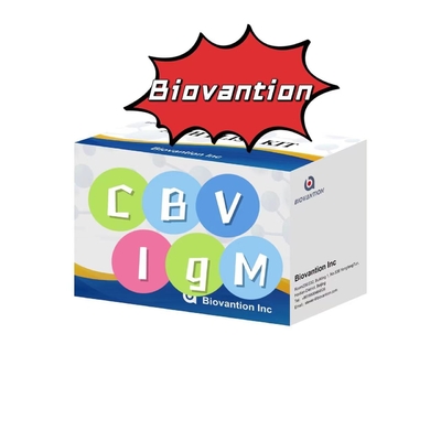 Kit diagnostico per anticorpi IgM contro CBV Kit di prova Elisa 50μL siero Diagnostica medica