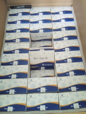Kit di collaudo HCV ELISA Esemplari in blocco senza reazione incrociata per test precisi