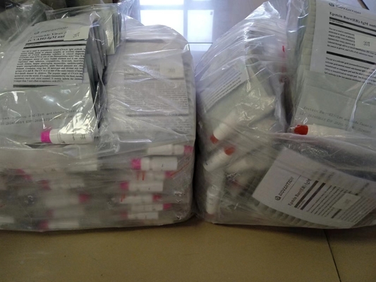 Virus di Coxsackie A16 CVA16-IgM Anticorpi Cassetta Rapid Test Siero Rapid Test Professionale
