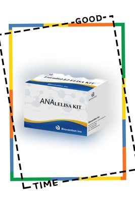 Kit di analisi ELISA anti-ANA IgG Anticorpo anti-IgG nucleare