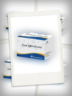 Kit di analisi ELISA di anticorpi IgE totali Siero/plasma per la diagnosi in vitro