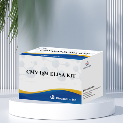 Test ELISA qualitativo IgM dei macrofagi Kit sperimentale IVD Altamente sensibile