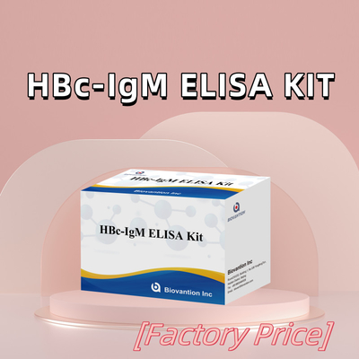 Test con reagenti diagnostici per l'antgeno IgM HBc ad alta precisione con kit di test immunosorbente legato all'enzima