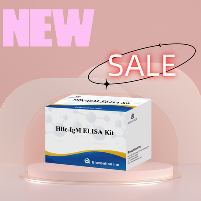 Test con reagenti diagnostici per l'antgeno IgM HBc ad alta precisione con kit di test immunosorbente legato all'enzima