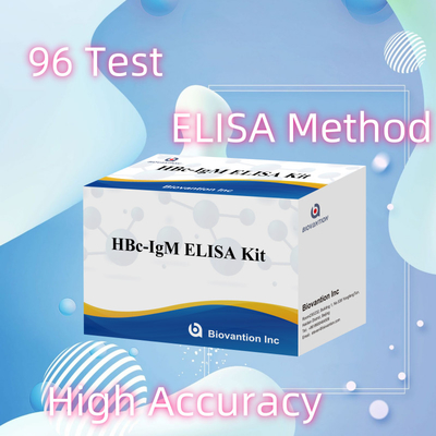 Test con reagenti diagnostici per l'antgeno IgM HBc ad alta precisione con kit di test immunosorbente legato all'enzima