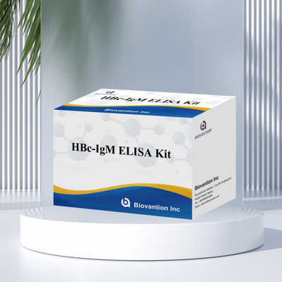 Test con reagenti diagnostici per l'antgeno IgM HBc ad alta precisione con kit di test immunosorbente legato all'enzima