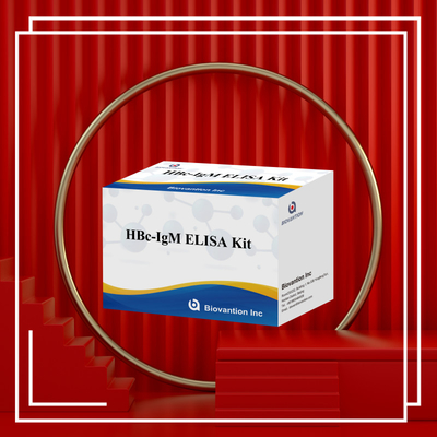 Test con reagenti diagnostici per l'antgeno IgM HBc ad alta precisione con kit di test immunosorbente legato all'enzima