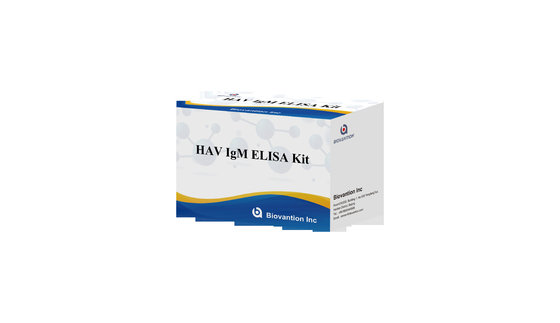 HAV IgM Elisa Test Epatite A Kit diagnostico In vitro Enzima immunoassay