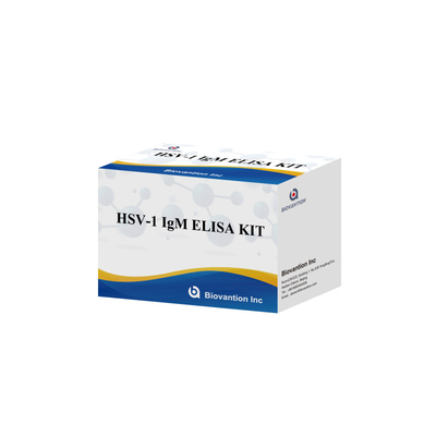 Diagnosi medica dell' HSV-1 IgM Kit di prova Elisa con durata di conservazione di 18 mesi Origine