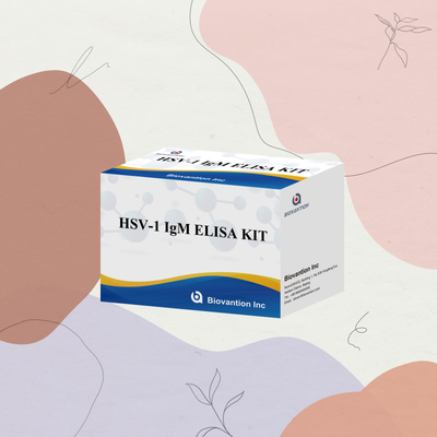 Diagnosi medica dell' HSV-1 IgM Kit di prova Elisa con durata di conservazione di 18 mesi Origine