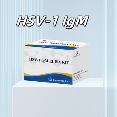 Diagnosi medica dell' HSV-1 IgM Kit di prova Elisa con durata di conservazione di 18 mesi Origine