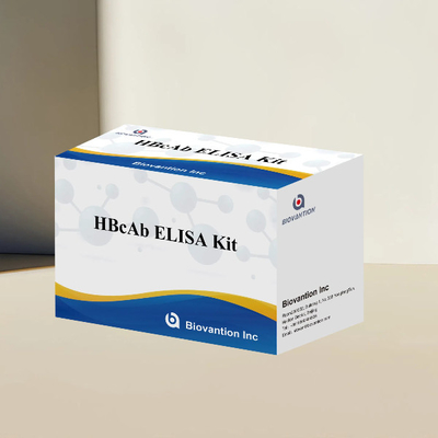 Kit di analisi HBcAb ELISA Assay Kit di rilevazione degli anticorpi Qualitativo