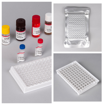 Reagente IVD HIV Ab Ag Kit di prova Elisa Alta sensibilità / specificità