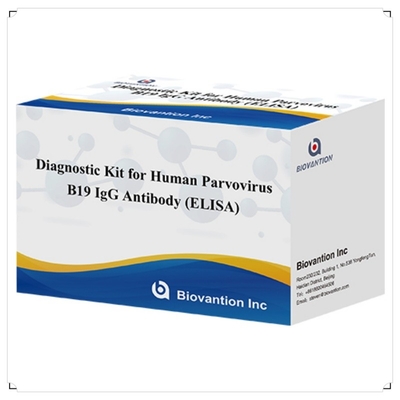 Kit diagnostico per uso umano per il parvovirus B19 IgM anticorpo umano Kit di prova Elisa con 96T