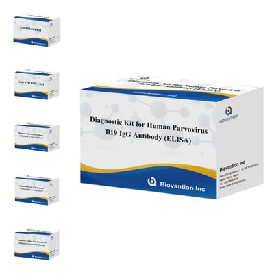 Kit diagnostico per uso umano per il parvovirus B19 IgM anticorpo umano Kit di prova Elisa con 96T