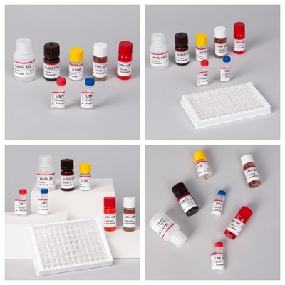 Reagenti di immunoassay enzimatici Kit di prova Elisa per la rilevazione di anticorpi CMV del citomegalovirus