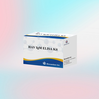 HAV IgM ELISA Kit Alta sensibilità Epatite A Virus Detection Test diagnostico accurato e affidabile per laboratori clinici