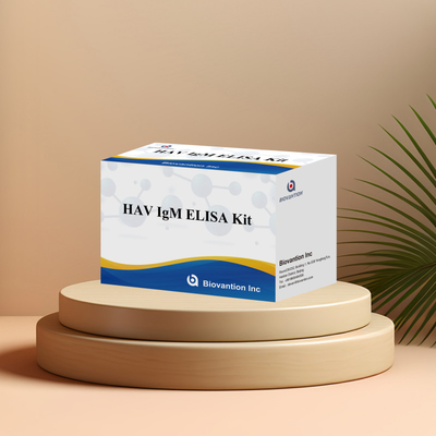 HAV IgM ELISA Kit Alta sensibilità Epatite A Virus Detection Test diagnostico accurato e affidabile per laboratori clinici