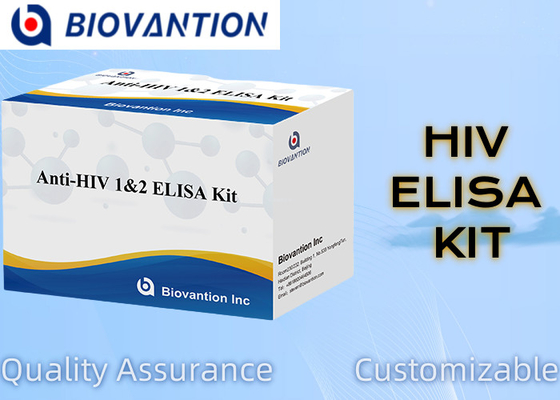 Kit avanzato di analisi anti-HIV ELISA1/2 per analisi sensibili e specifiche di disturbi neurologici