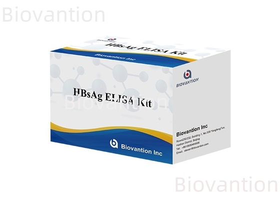Kit di prova Elisa per HBsAg altamente sensibile per la diagnosi accurata di varie sostanze